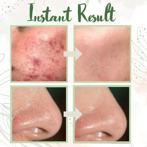 GREEN TEA MASK™ | DEEP PORE CLEANSER