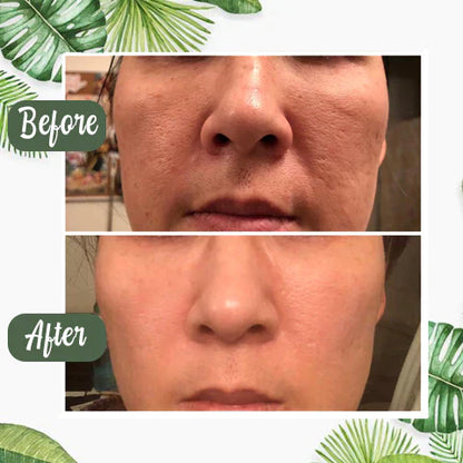 GREEN TEA MASK™ | DEEP PORE CLEANSER